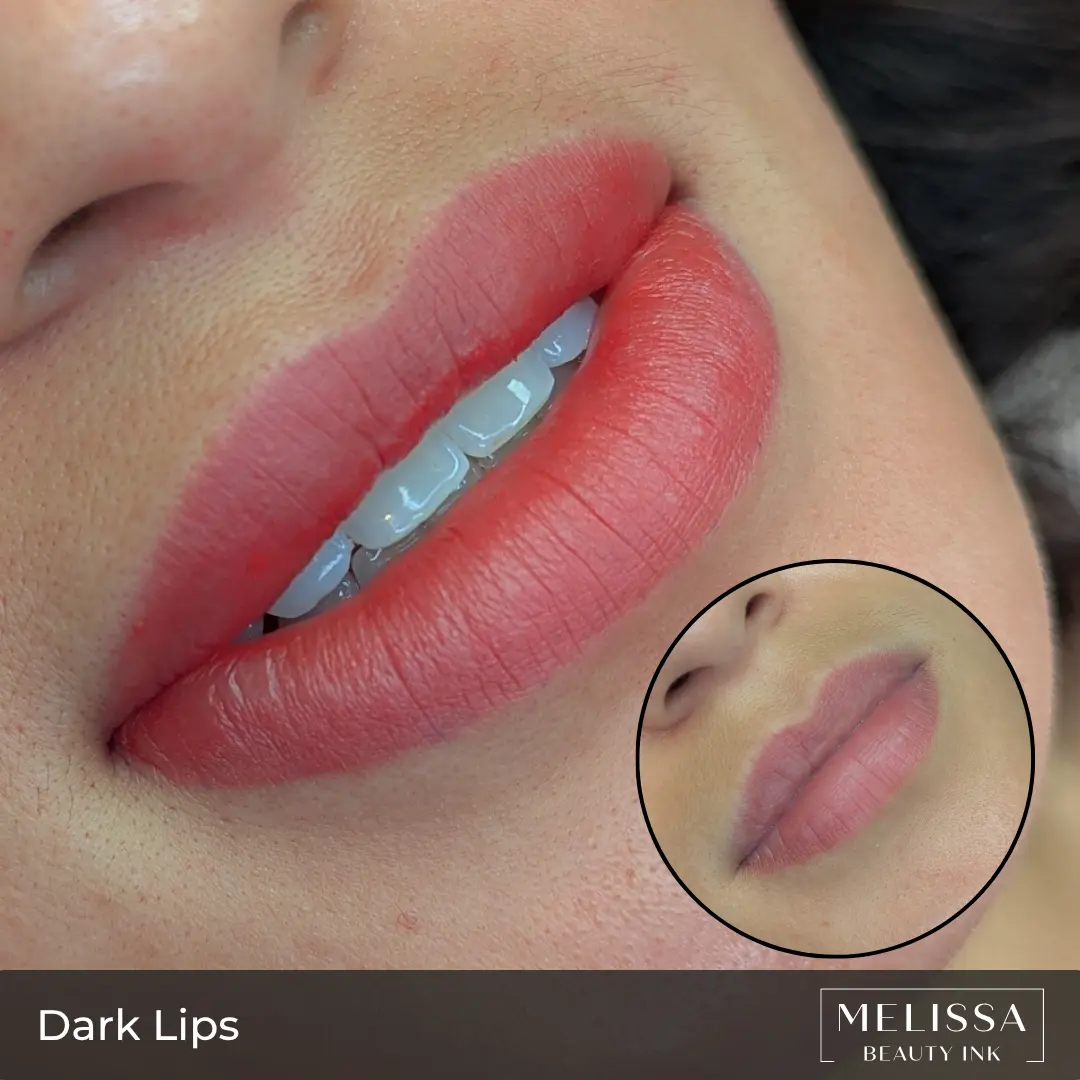 Dark Lips